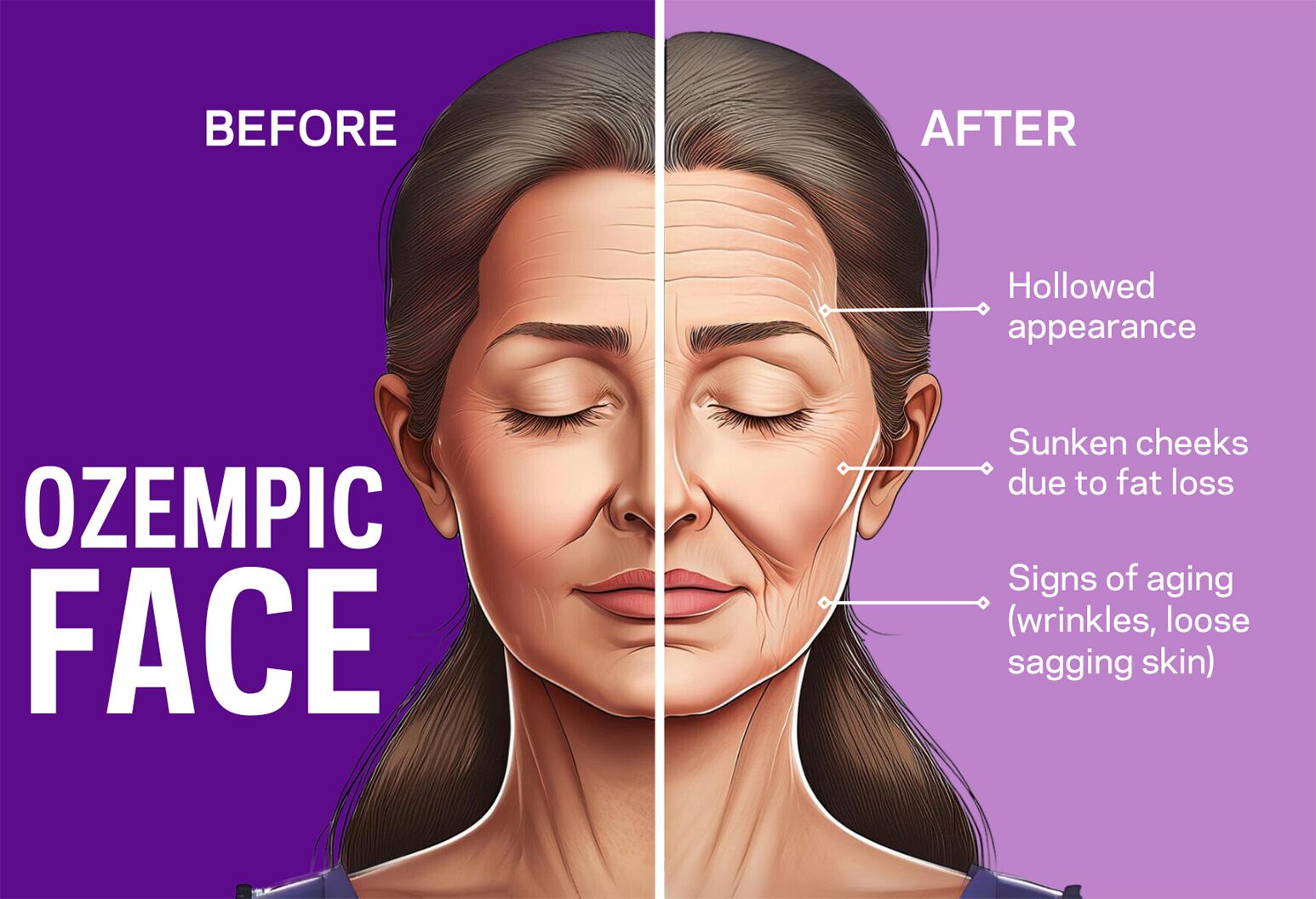 People that take Ozempic could lose muscle as a side effect. People that take Ozempic could lose muscle as a side effect.
