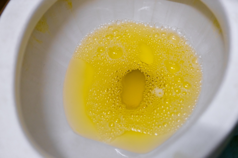 Brightly colored yellow "expensive" urine in the toilet.