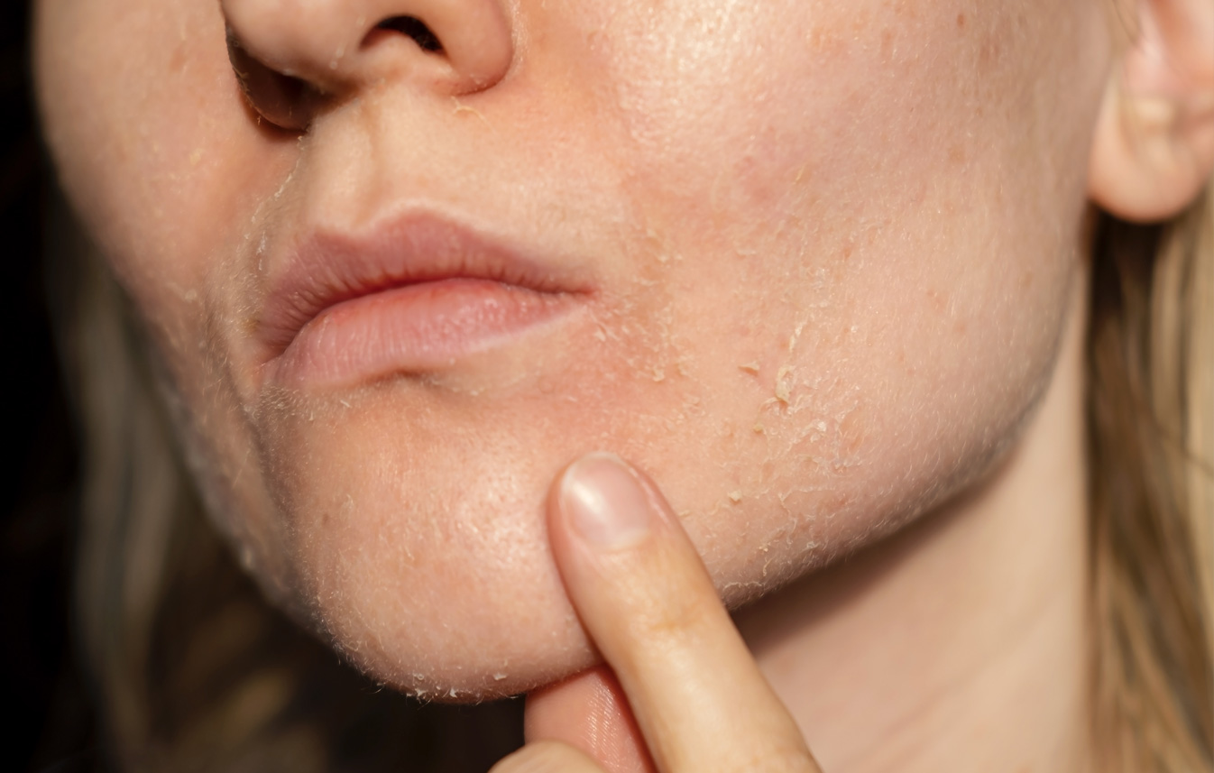 If your too acidic, you may have skin rashes and dry skin.