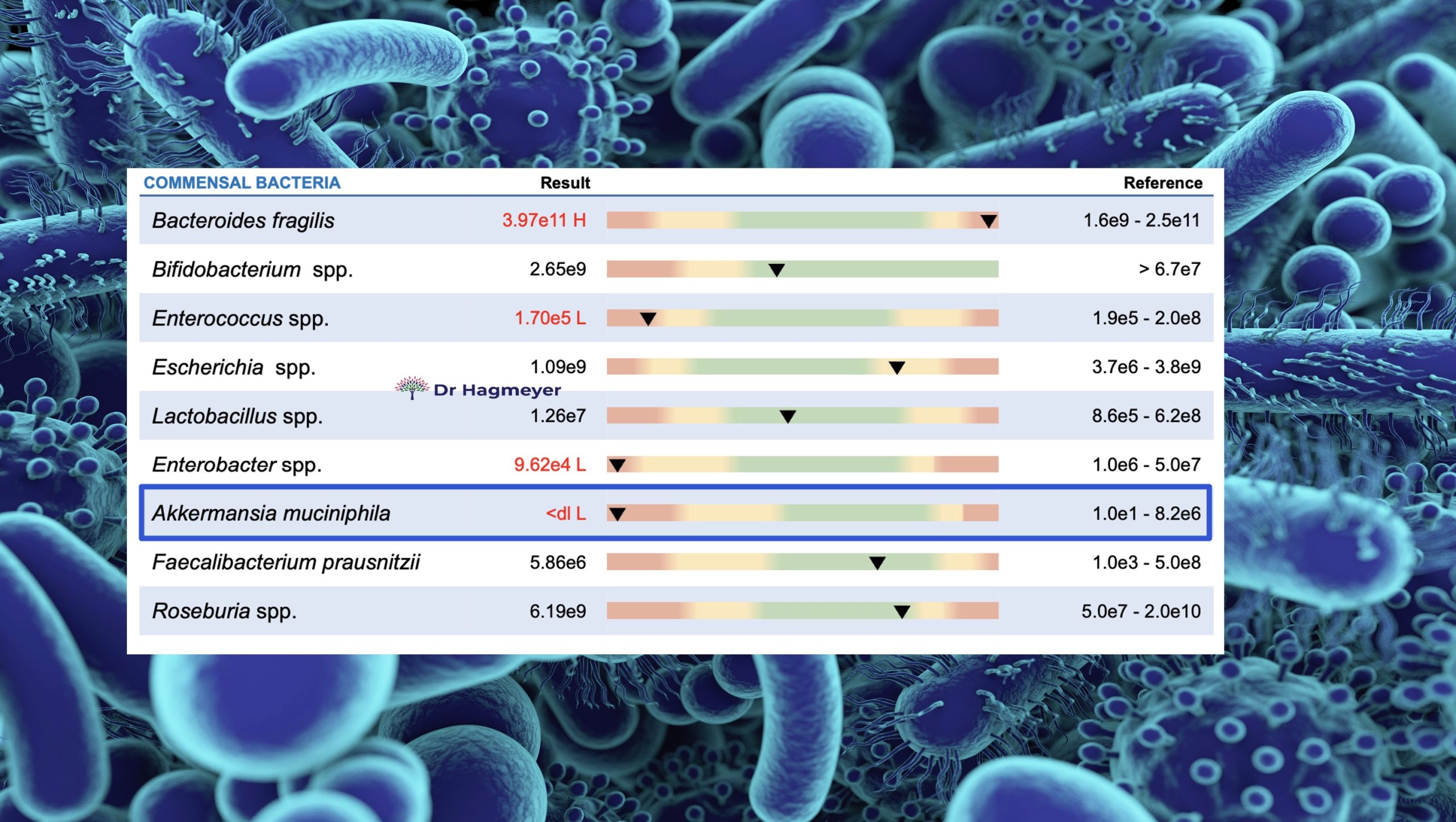 Stool test results for Akkermansia and other good microbes. Stool test results for Akkermansia and other good microbes.